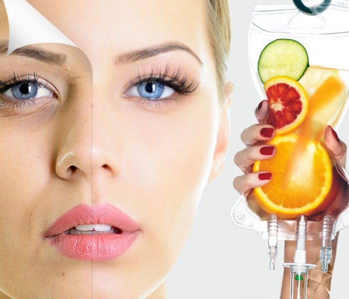 Beautify-IV-Therapy