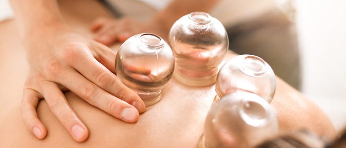 Could_You_Benefit_From_Cupping_Therapy