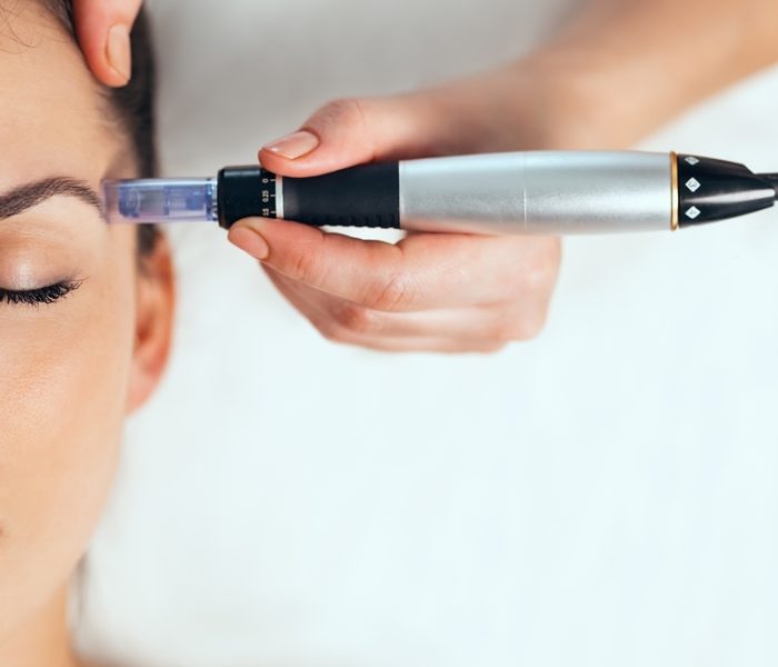 Shot,Of,Cosmetologist,Making,Mesotherapy,Injection,With,Dermapen,On,Face