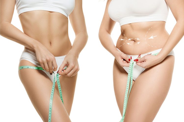 bigstock-Two-Young-Thick-And-Thin-Women-281341615